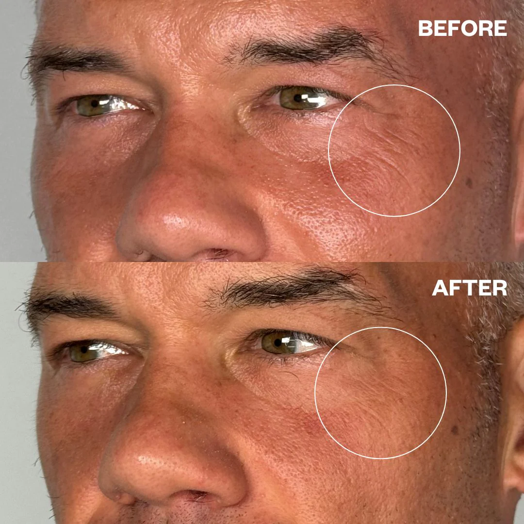 Men's Eye & Forehead Bundle - Image 5