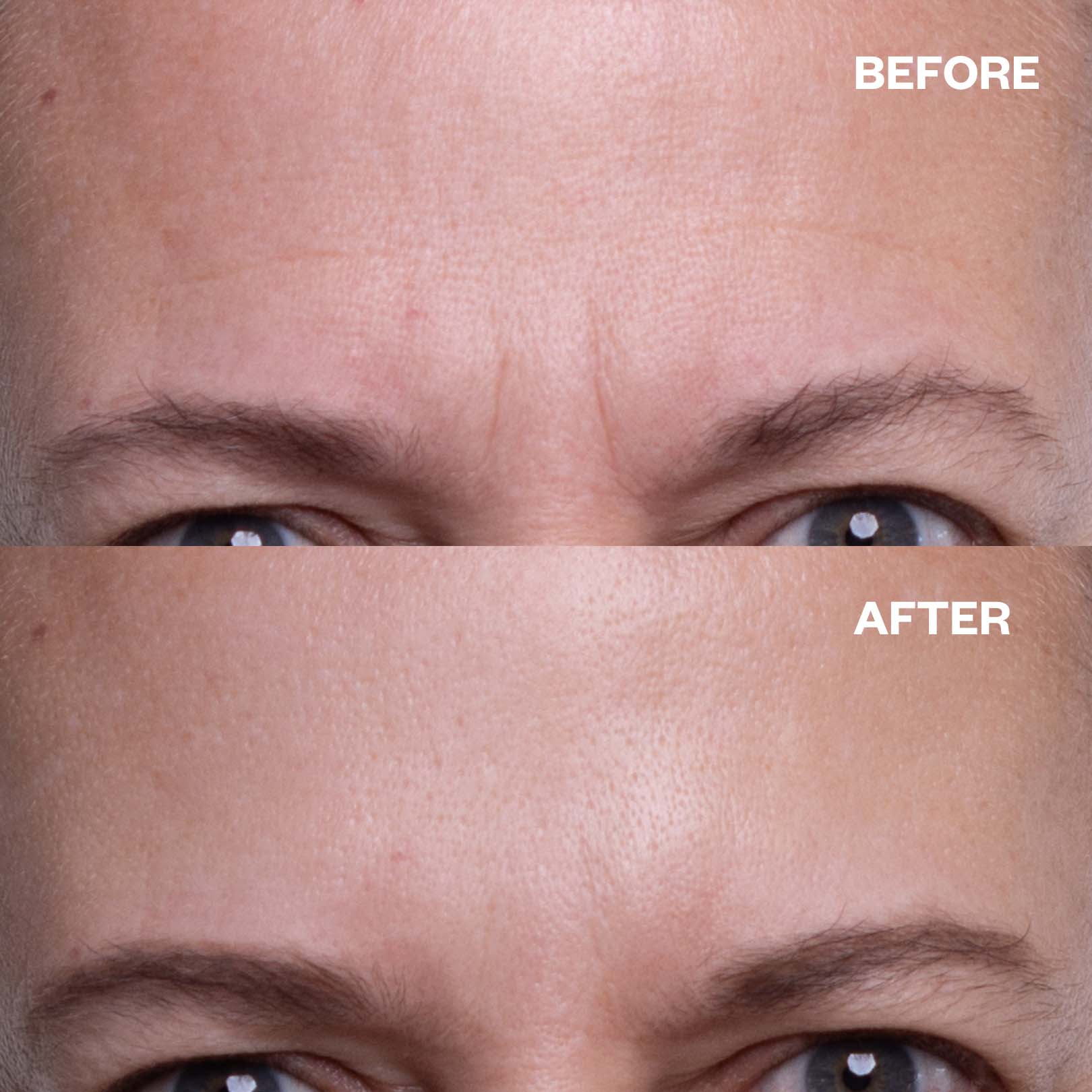 Photo-Ready Skin Bundle - Image 5